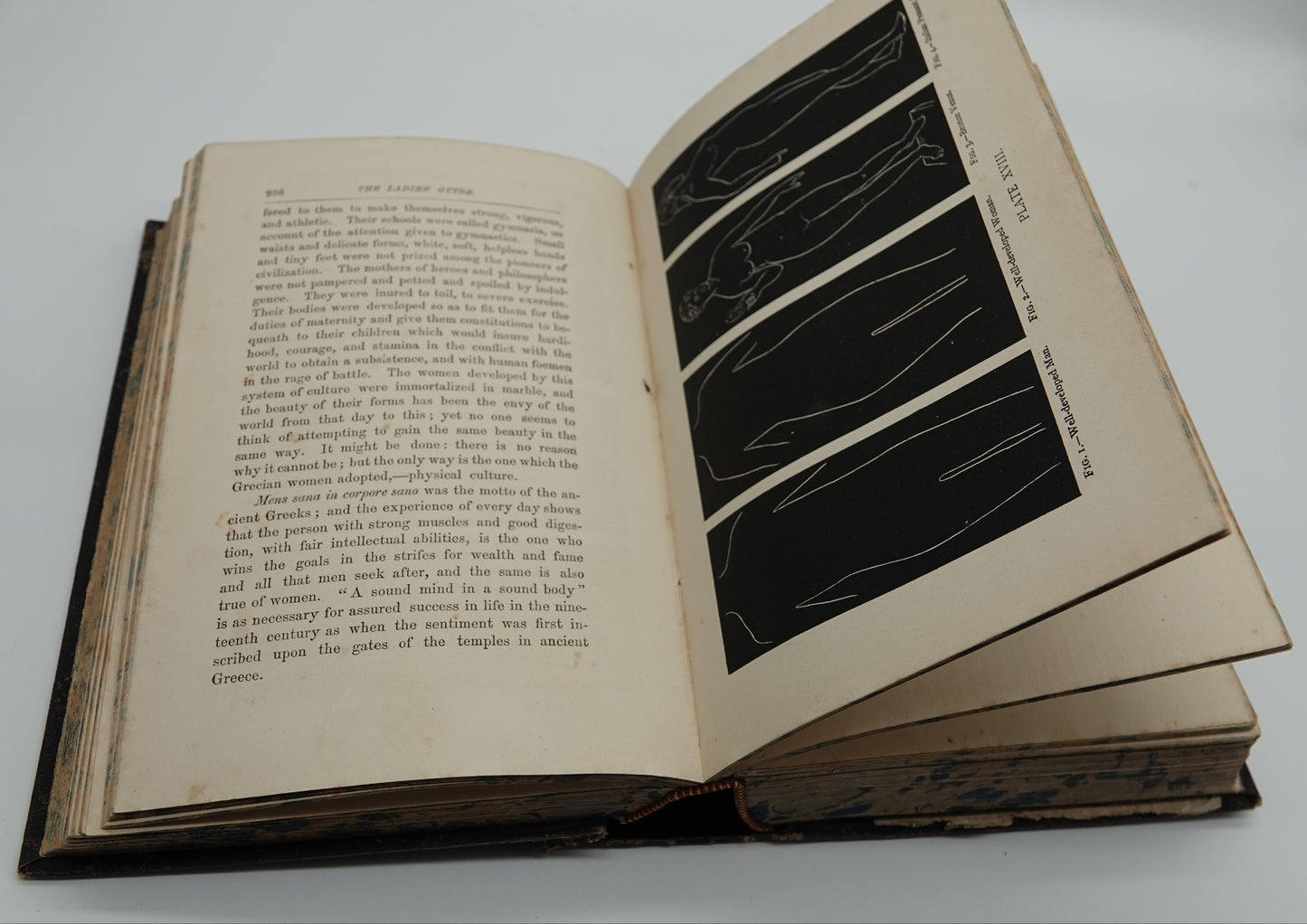 A first edition medical treasure.... Ladies Guide in Health and Disease” by J H Kellogg
